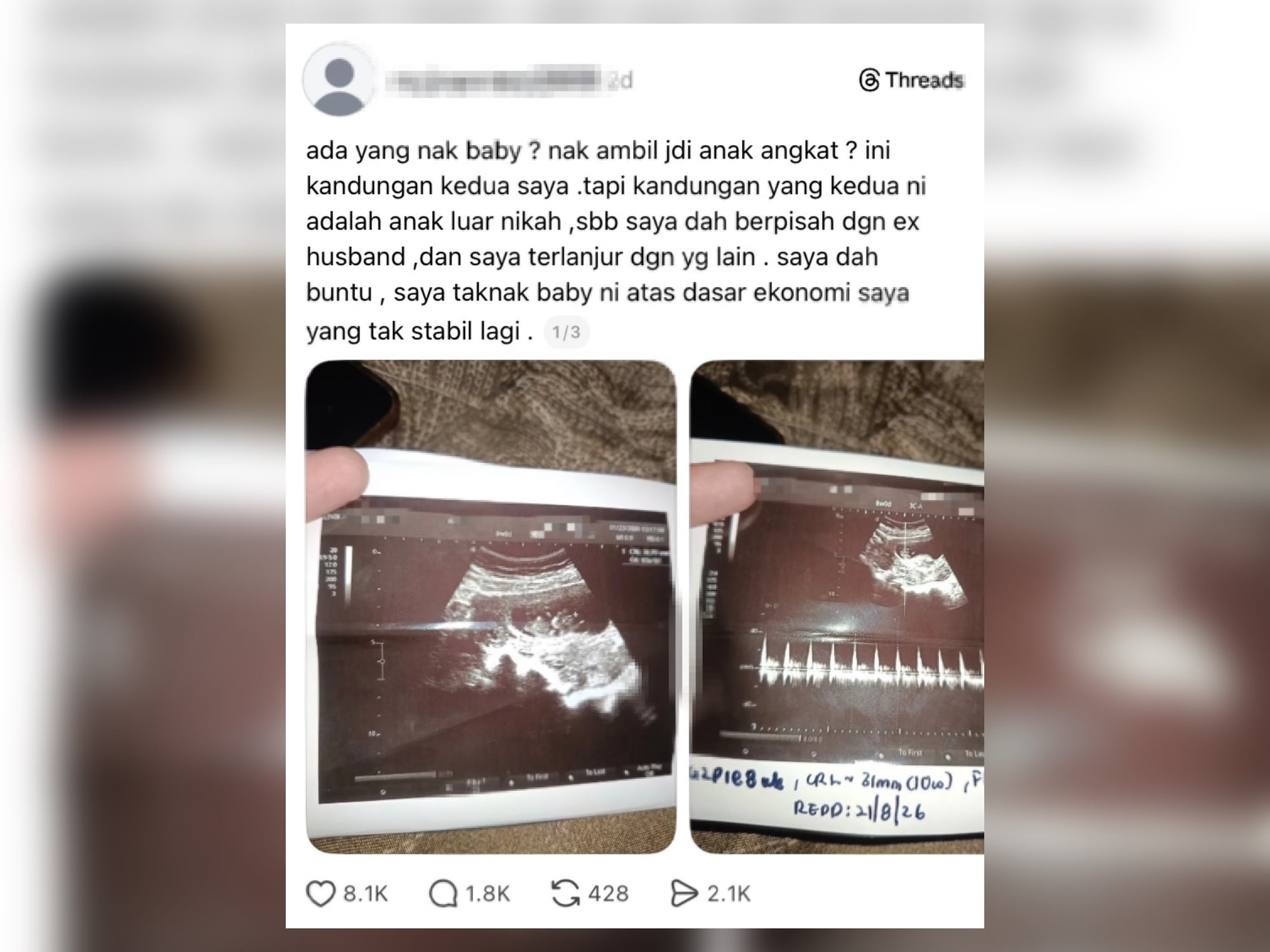 Budaya Kongsi Aib Makin Normal, Wanita Mengaku Terlanjur & Hamil Anak Luar Nikah Di Media Sosial