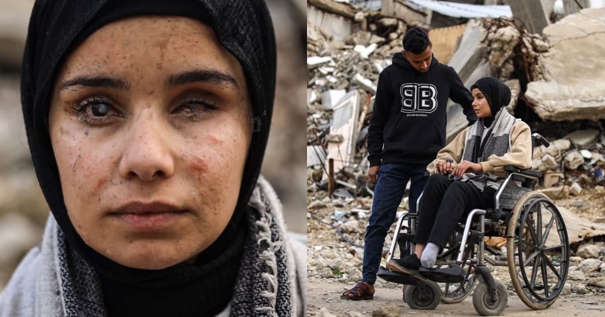 Gadis Palestin Hilang Anggota Badan & Ibu Bapa Pada Usia 17 Tahun Dalam Serangan Israel