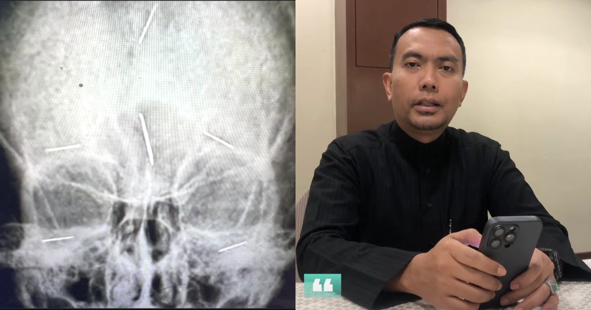 Bahaya Enggan Buang Susuk, Dr. Izhar Beri Amaran Dosa Besar Syirik & Azab Ubah Ciptaan Allah