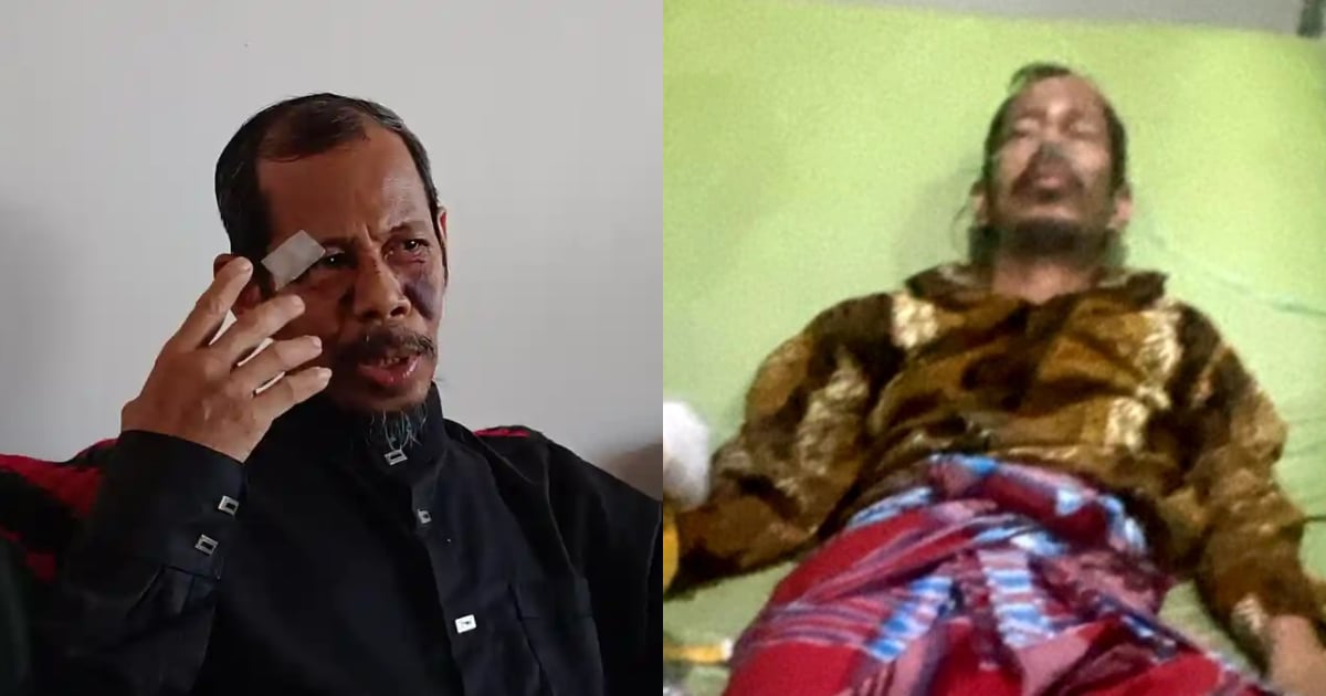 Imam Masjid Dipukul Hingga Cedera Parah Selepas Tegur Kanak-Kanak Main Pembesar Suara & Azan Awal